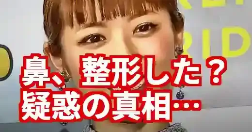 若槻千夏の鼻は整形？昔の鷲鼻から現在まで時系列で徹底比較！
