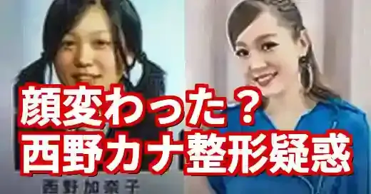 西野カナの整形疑惑を徹底検証！顔変わったと言われる真相は？