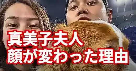 【なぜ？】真美子夫人の顔が変わった３つの理由！最新の姿を徹底分析