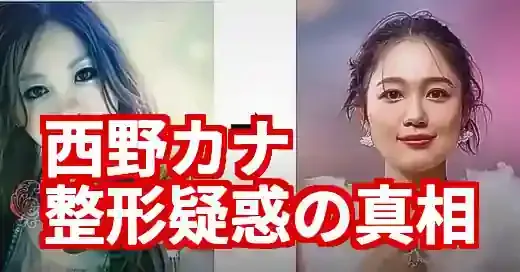 【比較画像】西野カナの整形疑惑を徹底検証！復帰で顔変わった？