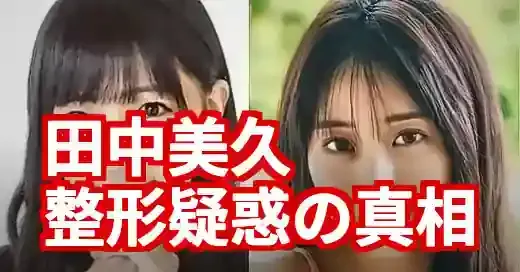田中美久の整形疑惑に終止符か？涙袋と鼻の変化を時系列で徹底検証